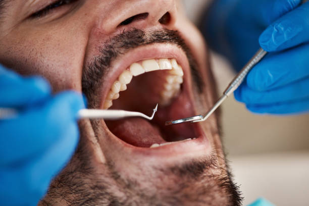 Best Emergency Dental Services for Seniors in Ashburn, GA